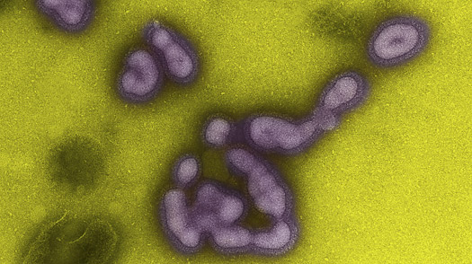 Influenza A(H1N1)